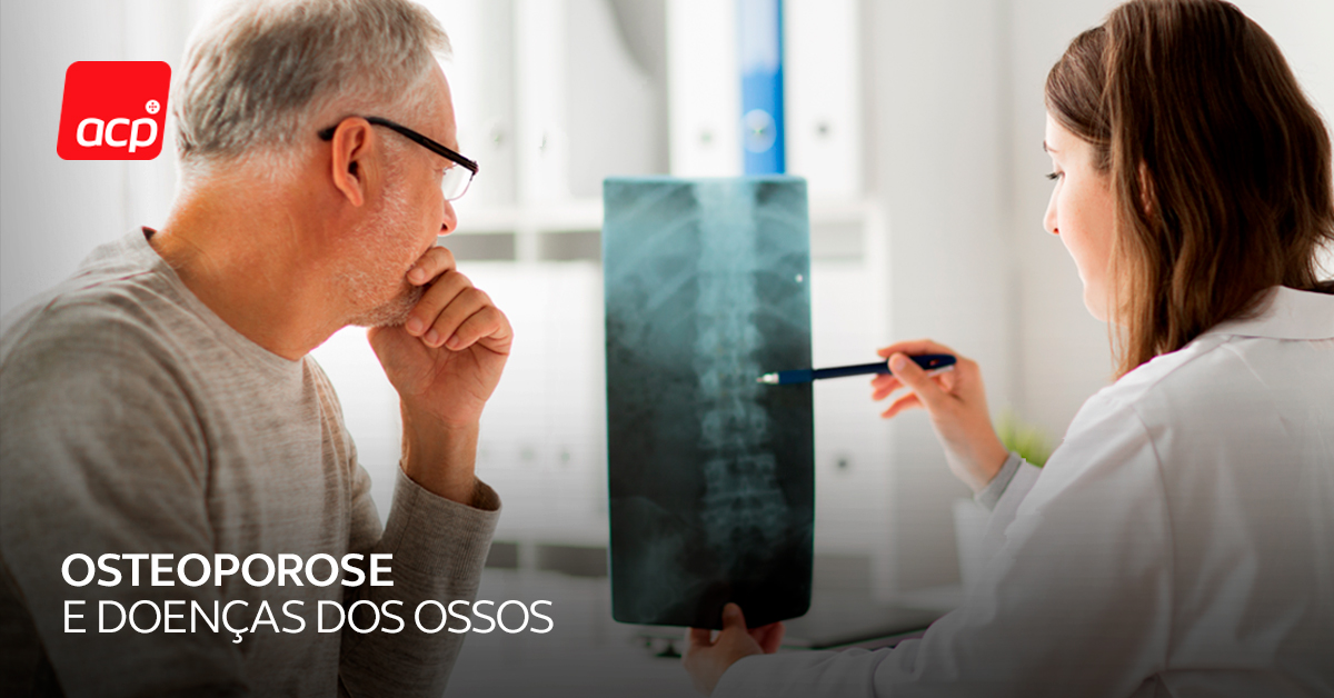 Como Prevenir A Osteoporose E Outras Doen As Dos Ossos Acp